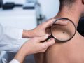 Skin Cancer | Skindoc Dermatologists | Liverpool Sydney | Dr Jennifer Yip